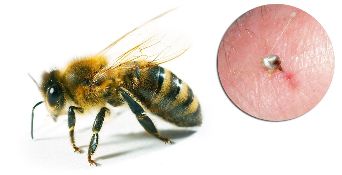 Súčasťou Hondrostrong obsahujú včelí jed, čo zlepšuje metabolické procesy v tkanivách